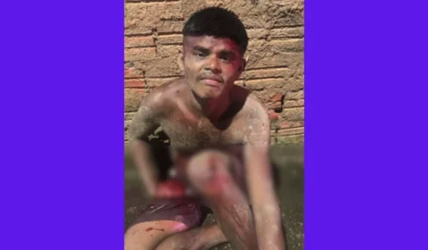 Apenado fica com dedos decepados após tentativa de furto na zona Norte de Porto Velho