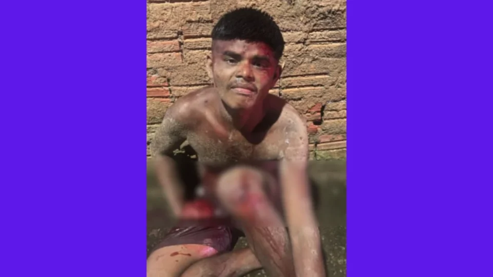 Apenado fica com dedos decepados após tentativa de furto na zona Norte de Porto Velho