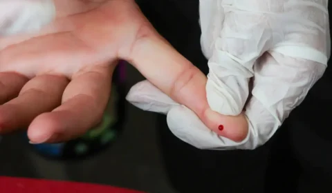 Dengue tem novo método de diagnóstico disponível no SUS