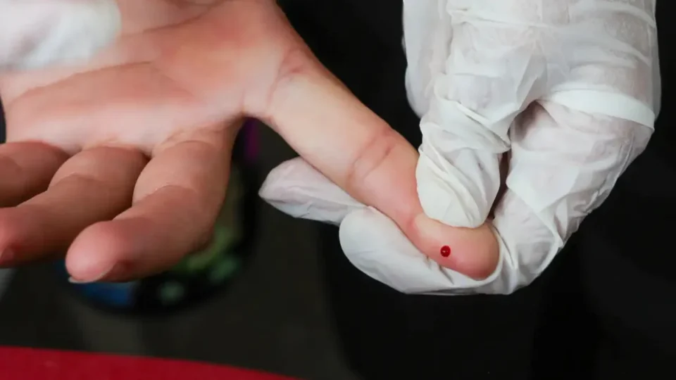 Dengue tem novo método de diagnóstico disponível no SUS