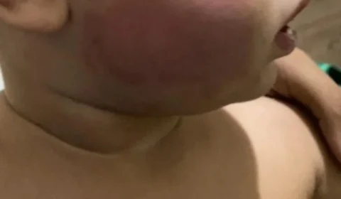 Bebê sofre tortura e casal é preso após culpar cachorro pelo crime