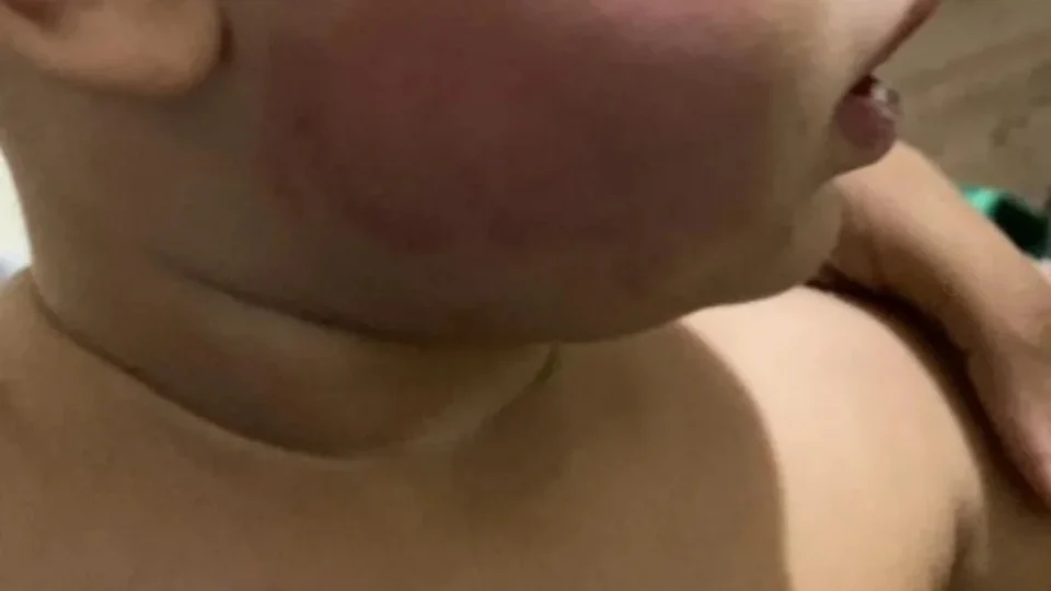 Bebê sofre tortura e casal é preso após culpar cachorro pelo crime