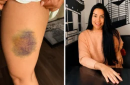 “Briguei pela vida”, diz nutricionista que enfrentou agressor por 13 minutos após invasão em apartamento