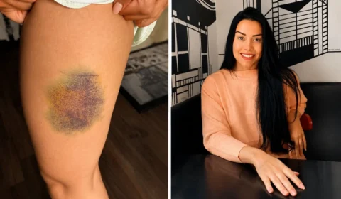“Briguei pela vida”, diz nutricionista que enfrentou agressor por 13 minutos após invasão em apartamento