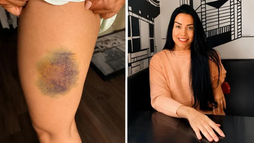 “Briguei pela vida”, diz nutricionista que enfrentou agressor por 13 minutos após invasão em apartamento