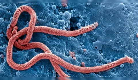 São Paulo investiga segundo caso suspeito de Ebola; paciente está isolada no Emílio Ribas