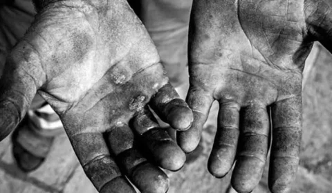 Trabalhadora doméstica é resgatada após 49 anos em condições análogas à escravidão