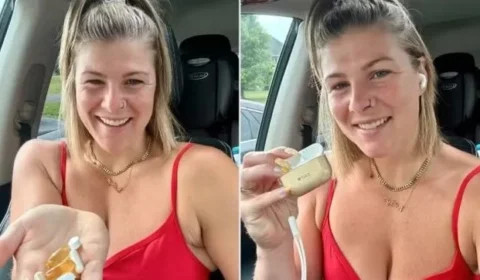 Mulher engole AirPod por engano ao tomar vitaminas e vive ”saga” para resolver caso