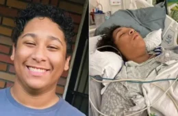 Bactéria ‘carnívora’ provoca necrose e deixa jovem de 17 anos em estado grave
