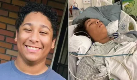 Bactéria ‘carnívora’ provoca necrose e deixa jovem de 17 anos em estado grave