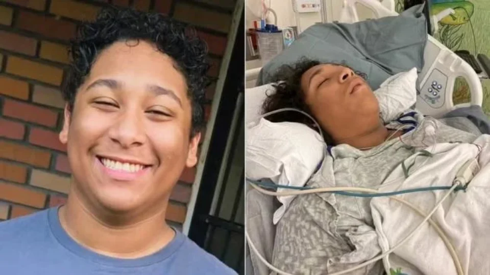 Bactéria ‘carnívora’ provoca necrose e deixa jovem de 17 anos em estado grave