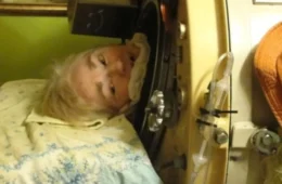 Morte de Martha Lillard encerra era do pulmão de aço nos EUA; veja as imagens