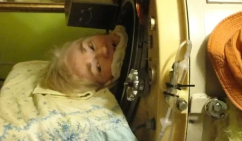 Morte de Martha Lillard encerra era do pulmão de aço nos EUA; veja as imagens