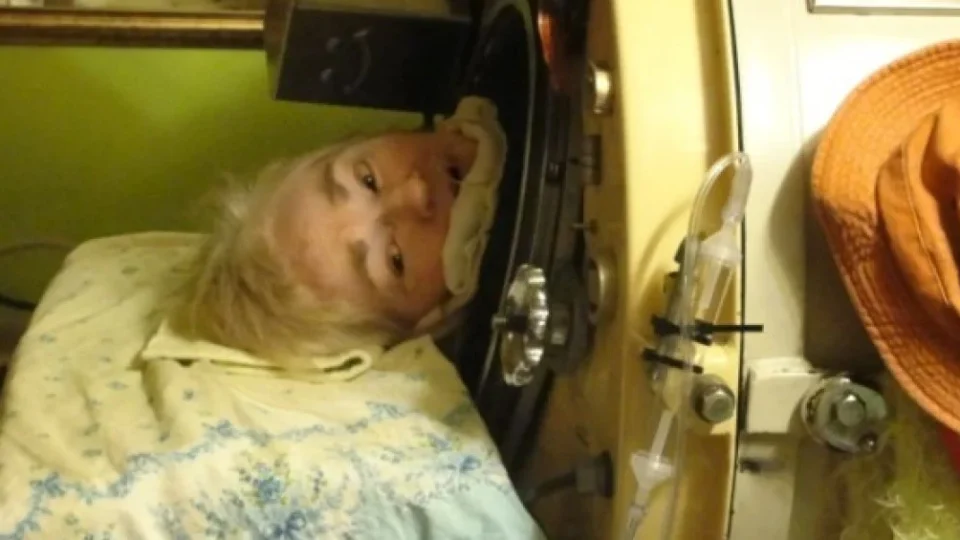 Morte de Martha Lillard encerra era do pulmão de aço nos EUA; veja as imagens