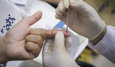 BH registra mais de 500 casos de hepatites virais em 2026 e reforça alerta para diagnóstico precoce