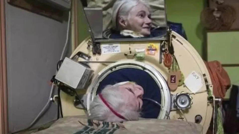 Morre aos 78 anos a última americana que dependia de um pulmão de aço para respirar