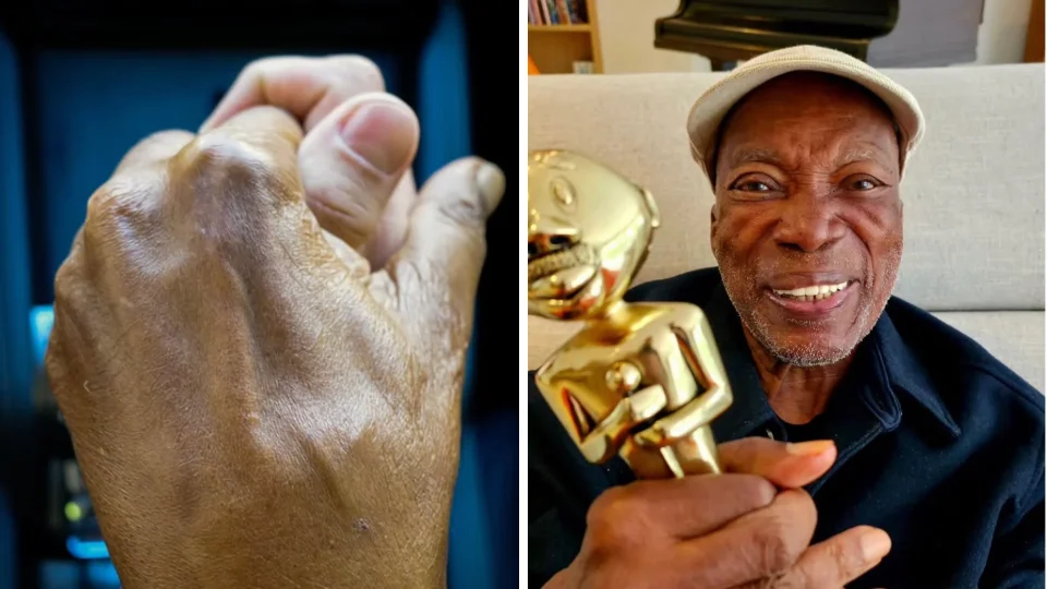 Bituca está em casa: filho de Milton Nascimento confirma alta após susto com saúde