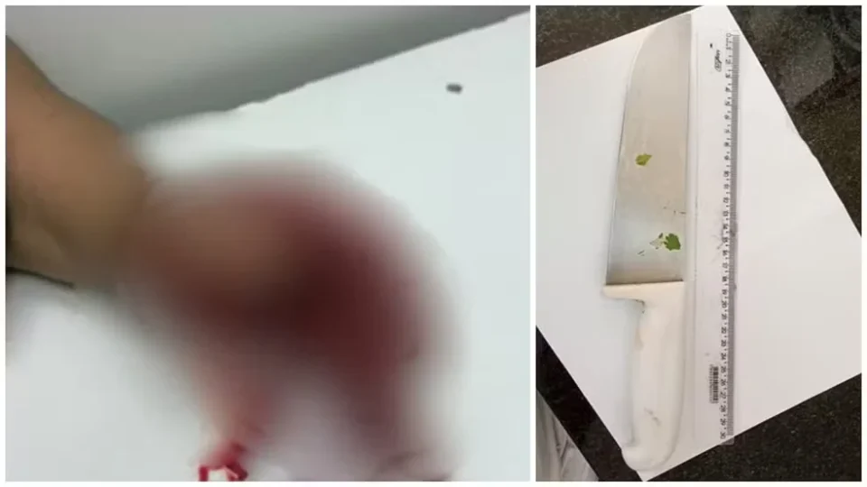 Acusado de decepar dedo da companheira deixa a prisão após decisão da Justiça