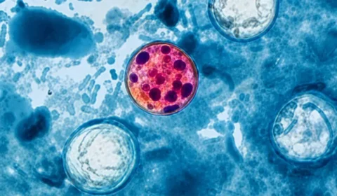 Surto de cyclosporíase nos EUA atinge 11 mil e expõe falhas