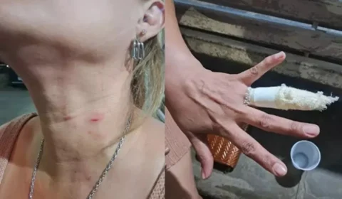 Confusão em shopping após crise de criança com autismo termina com mãe ferida e investigação