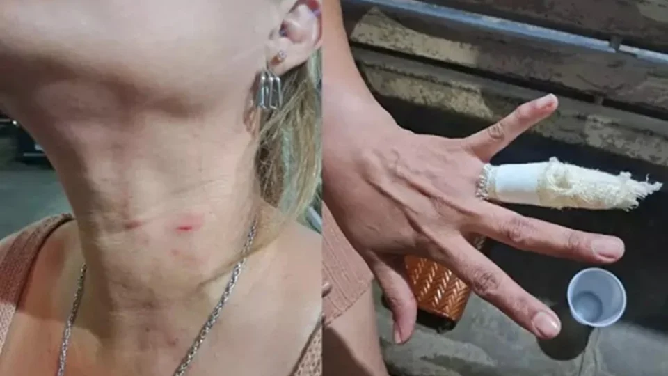 Confusão em shopping após crise de criança com autismo termina com mãe ferida e investigação