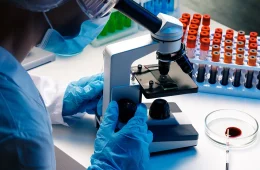 Exame de sangue pode revelar a idade biológica de cada órgão, aponta estudo