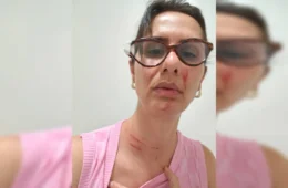 Enfermeira leva socos no rosto dentro de hospital público após orientar paciente a procurar UPA
