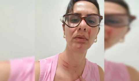 Enfermeira leva socos no rosto dentro de hospital público após orientar paciente a procurar UPA