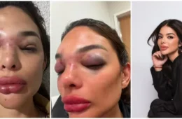 Mulher de empresário preso diz que pediu ajuda a seguranças durante agressão