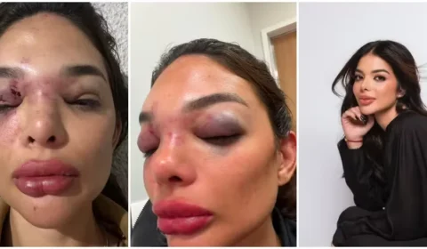 Mulher de empresário preso diz que pediu ajuda a seguranças durante agressão