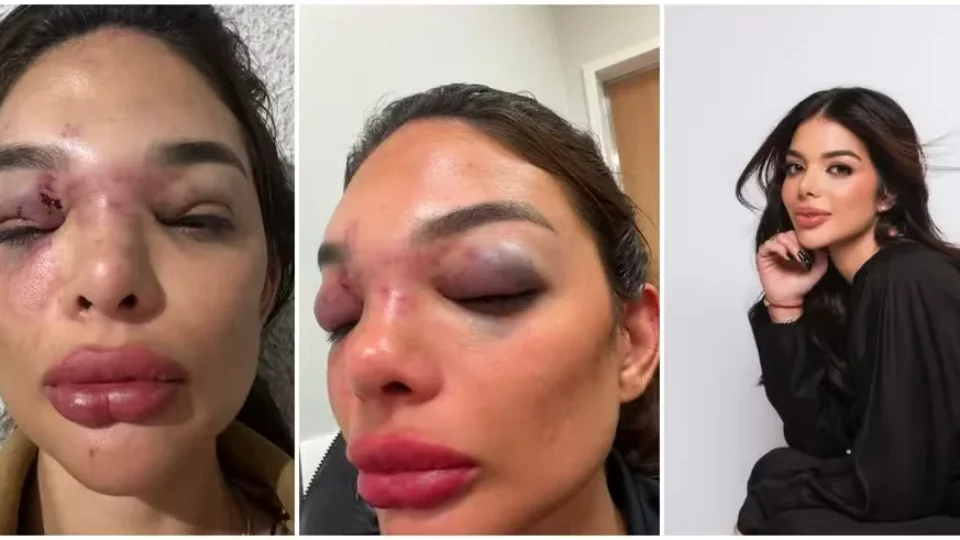 Mulher de empresário preso diz que pediu ajuda a seguranças durante agressão