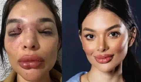 Vídeo mostra dentista sendo agredida por empresário da Faria Lima