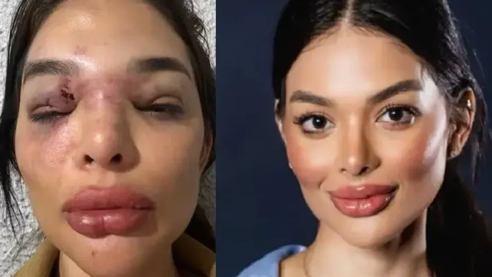 Vídeo mostra dentista sendo agredida por empresário da Faria Lima