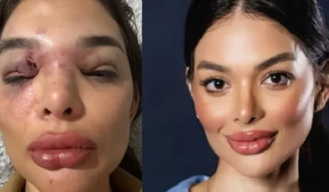 “Eu achei que ia morrer” Giullia Falcão relata agressões do marido em entrevista exclusiva
