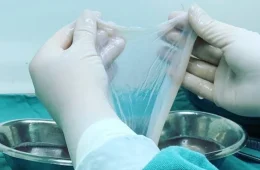 Cientistas usam membrana da placenta para tratar ferida difícil e evitar cirurgia