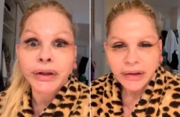 Monique Evans faz cirurgia no rosto e revela surpresa com resultado: “Não me reconheceram”