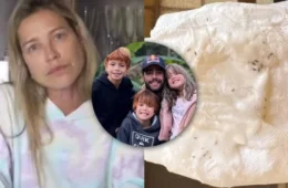 Briga entre Luana Piovani e Pedro Scooby levanta alerta: por que os piolhos aparecem e como acabar com eles