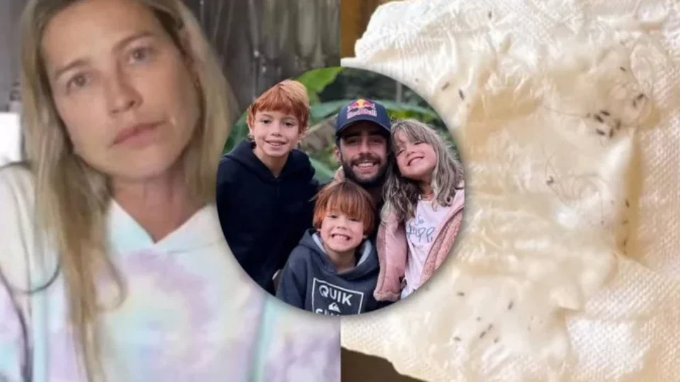 Briga entre Luana Piovani e Pedro Scooby levanta alerta: por que os piolhos aparecem e como acabar com eles