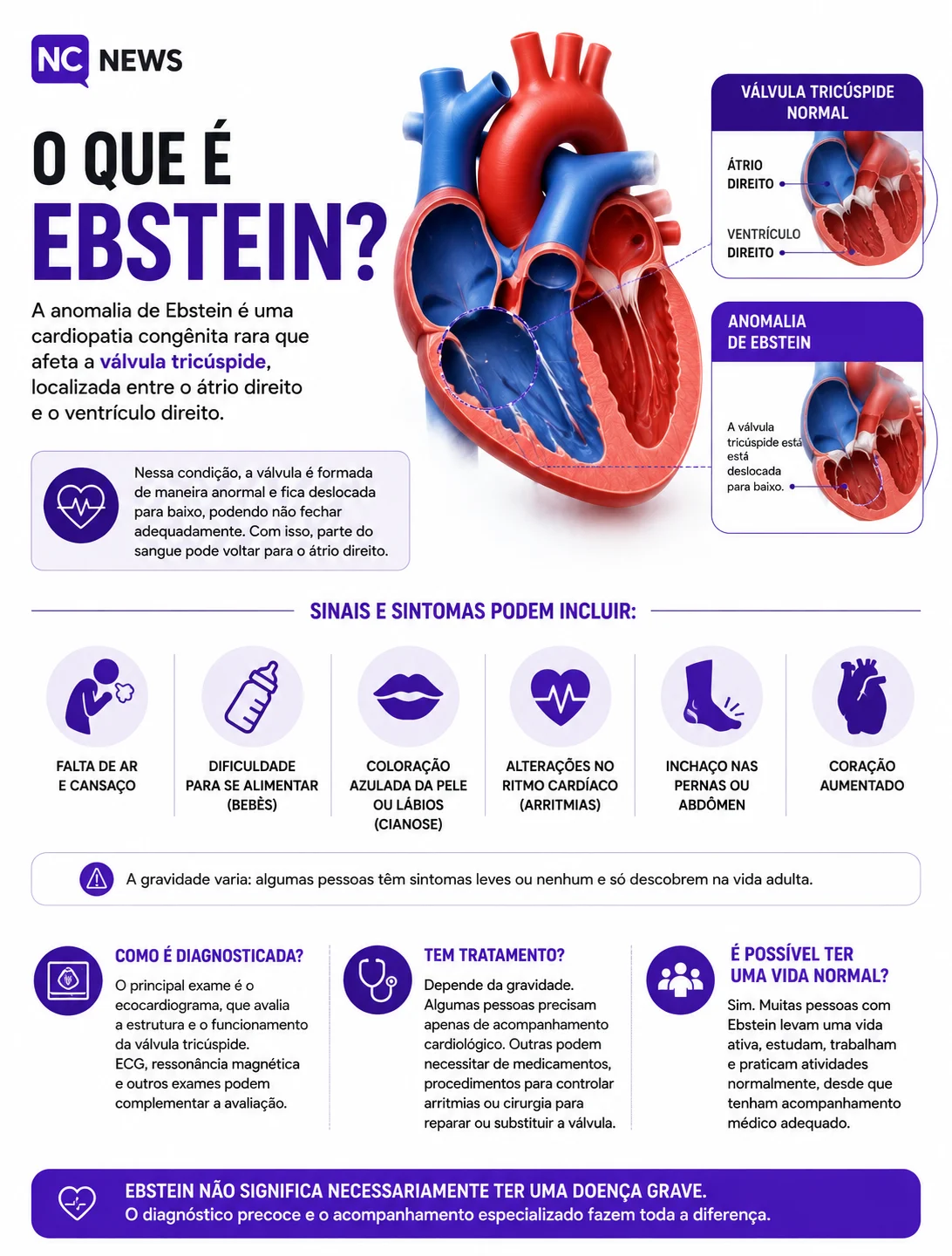 ebstein - nc news