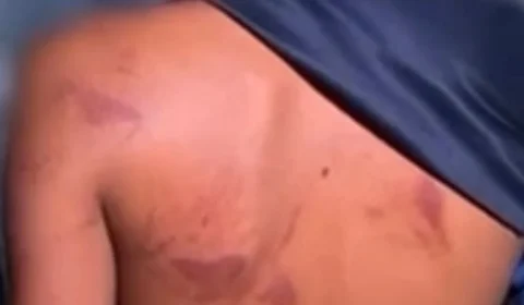 Pai é preso após espancar filho de 13 anos por causa de brinco
