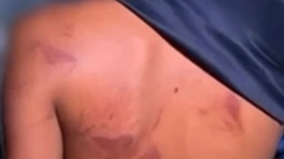 Pai é preso após espancar filho de 13 anos por causa de brinco