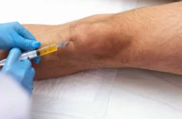 Infiltração no joelho funciona para todo mundo? Entenda benefícios, limites e riscos