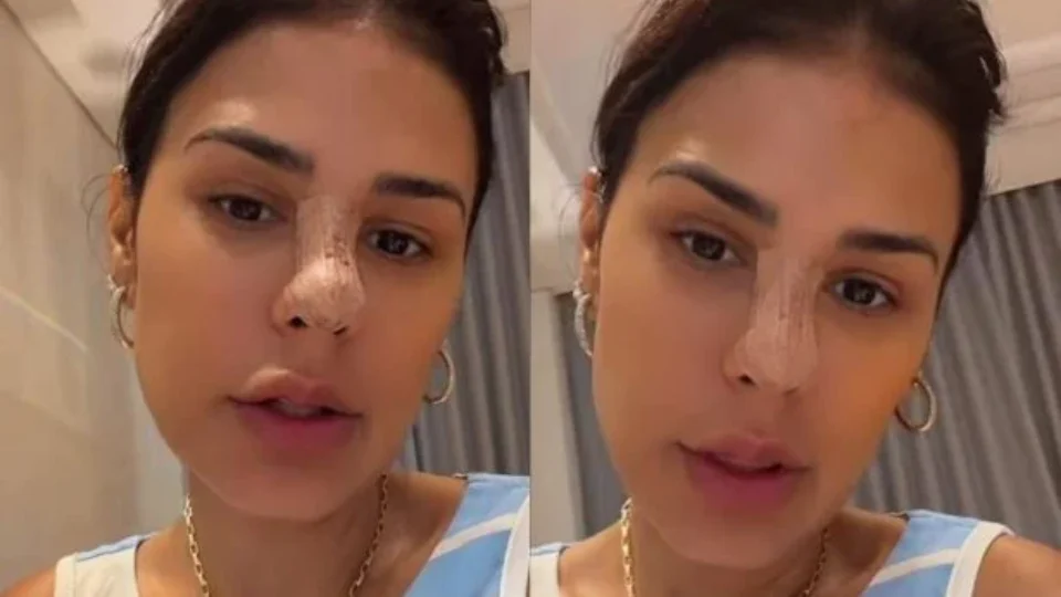 Simone Mendes faz procedimento no nariz; saiba quanto pode custar