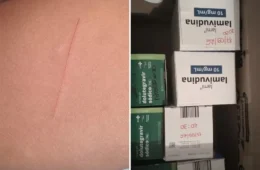 Criança leva navalha para escola e corta colega de 4 anos em Sete Lagoas