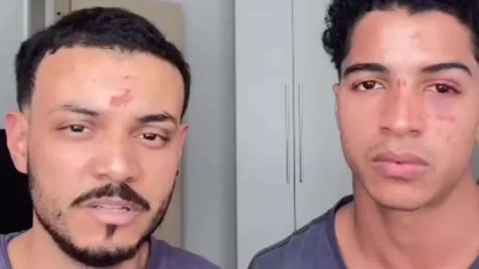 Casal denuncia agressão e homofobia após festa na UFRJ