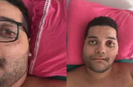 Motociclista fratura rosto e bacia em grave acidente na BR-364 e segue internado