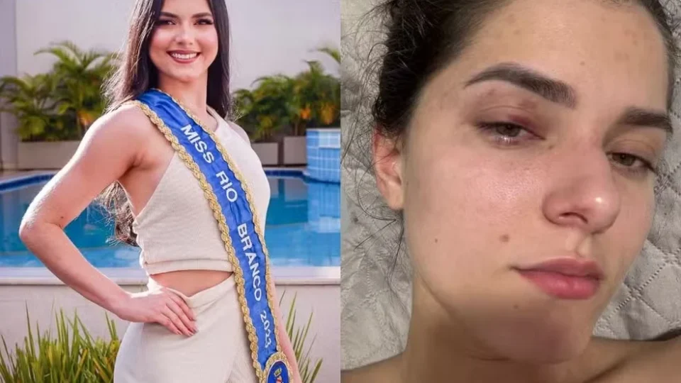 Empresário é condenado por agredir e ameaçar ex-Miss Universo Rio Branco após crise de ciúmes