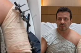 Médico abre vidro de carro blindado após golpe do retrovisor e acaba baleado no Rio