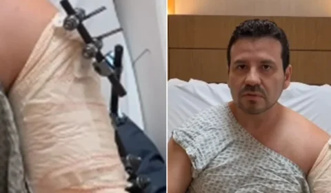 Médico abre vidro de carro blindado após golpe do retrovisor e acaba baleado no Rio