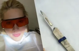 Virginia Fonseca faz microcirurgia após crise de enxaqueca e relata tratamento